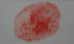 Agglutination